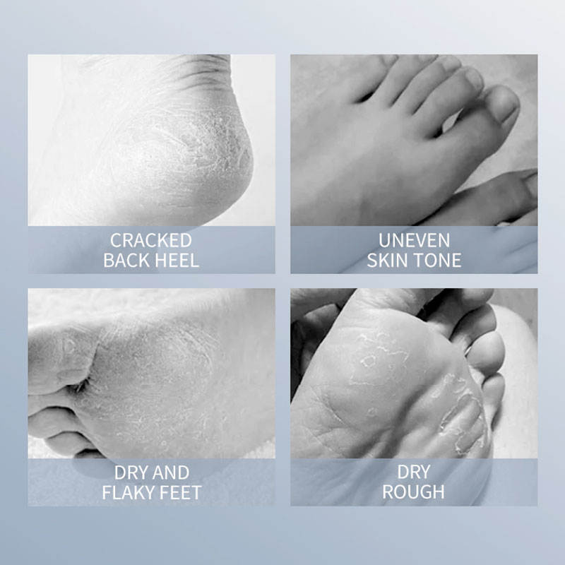 SADOER Maschera per i piedi al - Foot Mask Peeling recensione e prezzo