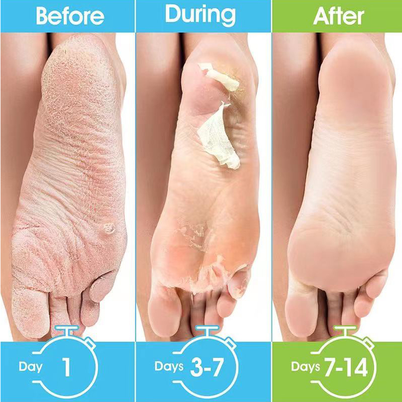 1 Pag=1 Paio di Maschere per P - Foot Mask Peeling recensione e prezzo
