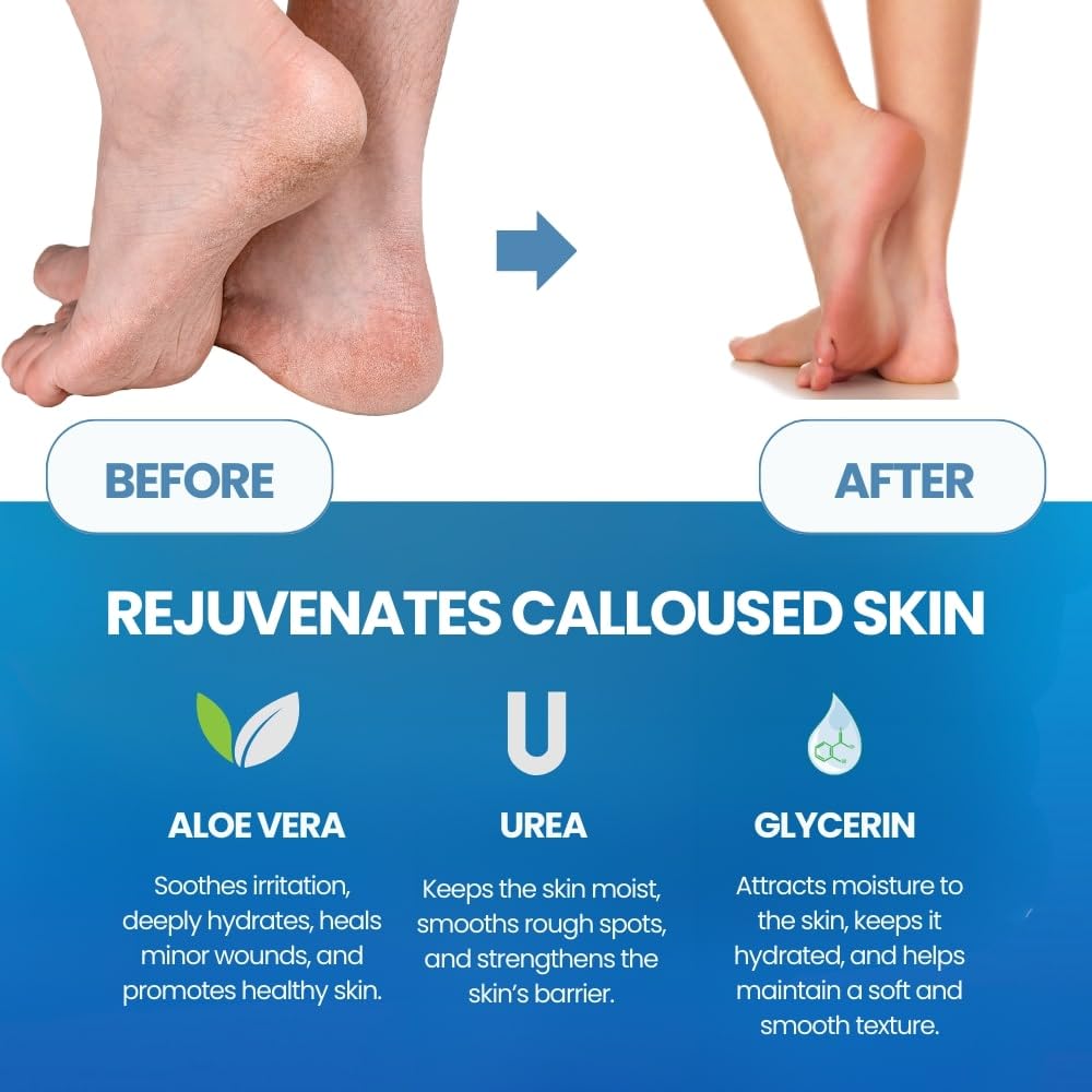 Maschera Esfoliante per Piedi, - Foot Mask Peeling recensione e prezzo