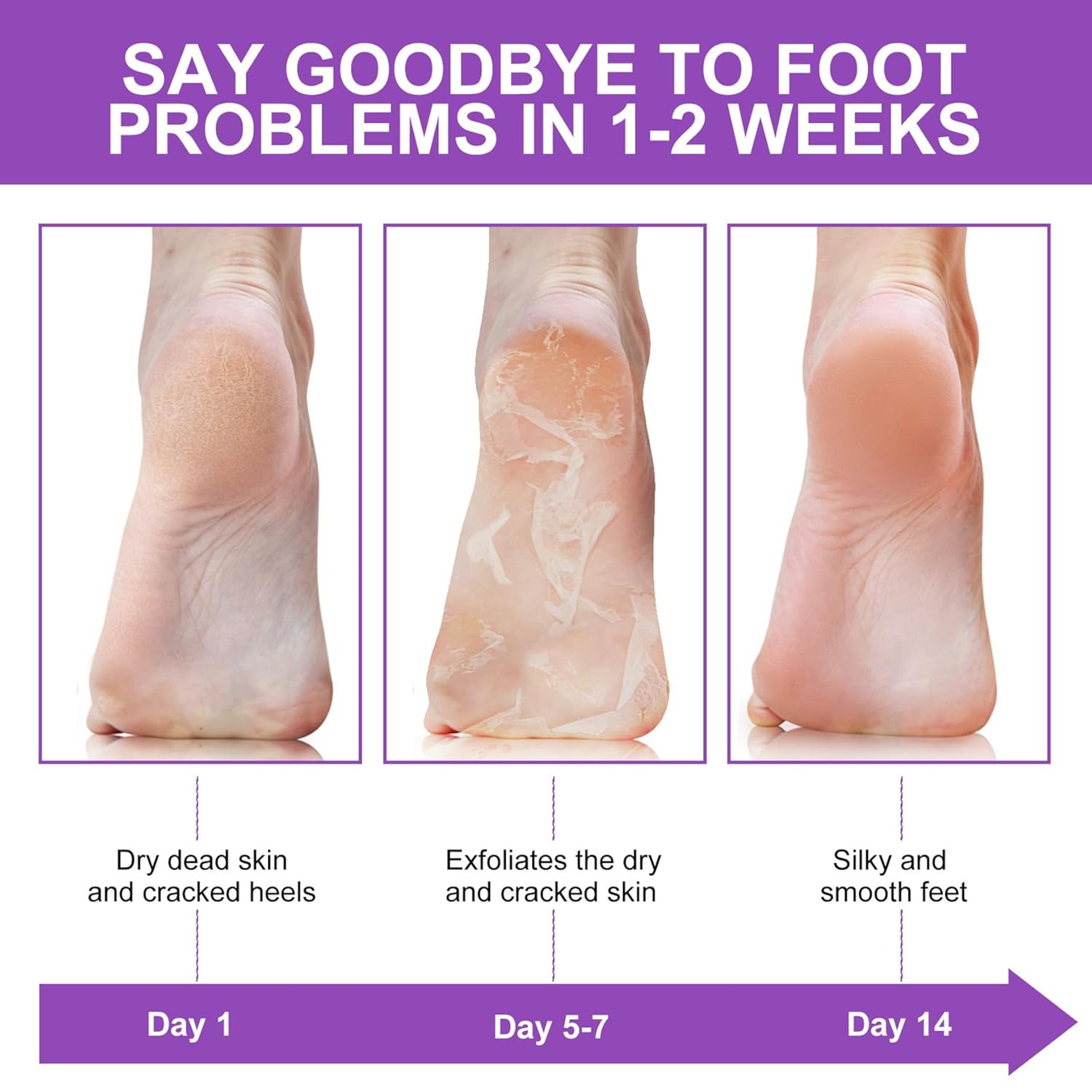 Calzini Esfolianti per Rimozio - Foot Mask Peeling recensione e prezzo