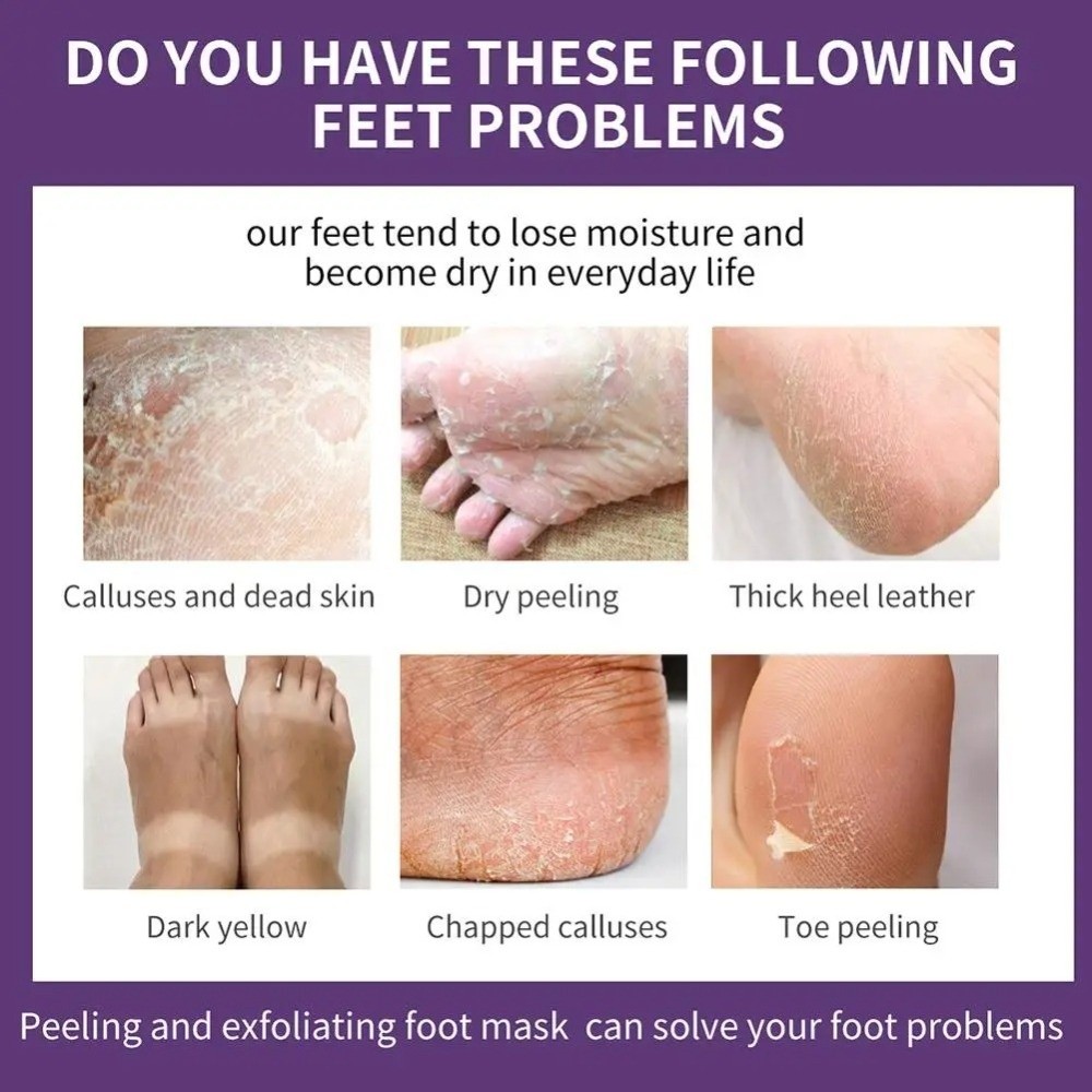 Maschera Esfoliante per Piedi  - Foot Mask Peeling recensione e prezzo
