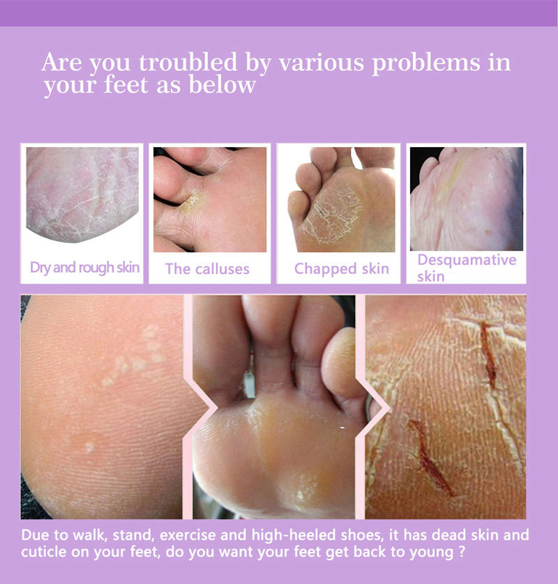 Maschere esfolianti per i pied - Foot Mask Peeling recensione e prezzo