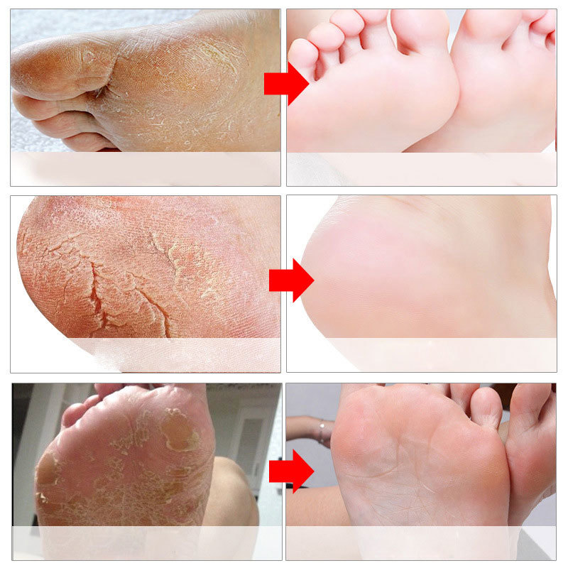 Maschere esfolianti per i pied - Foot Mask Peeling recensione e prezzo